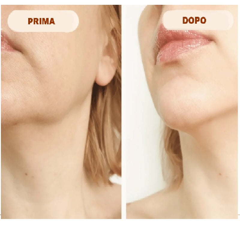 Skinbrush - Massaggiotore Facciale